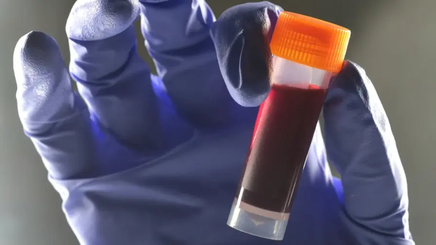 B kraujo grupė susijusi su didesne 2 tipo diabeto rizika