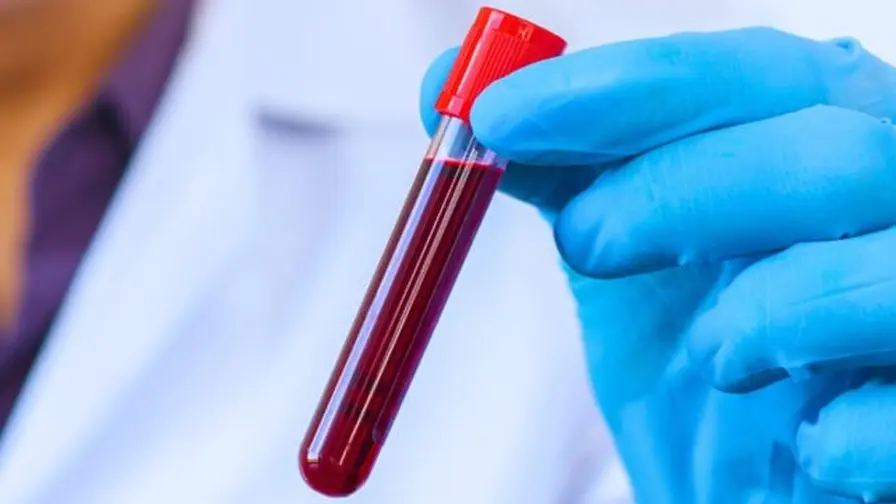 Monocitų biologinis senėjimas ir depresijos požymiai